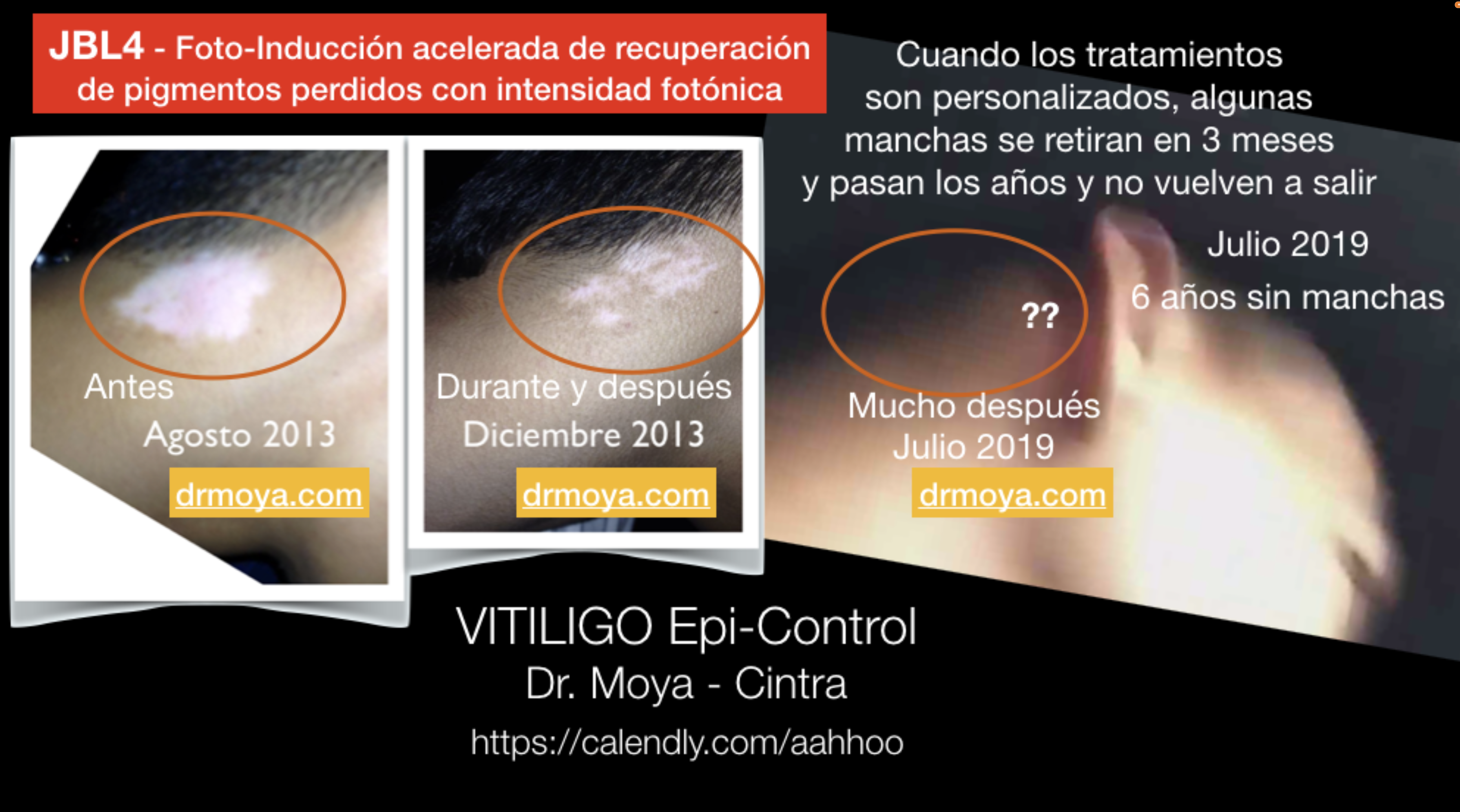 testimonios_libro_evitando_y_controlando_vitiligo_3.png