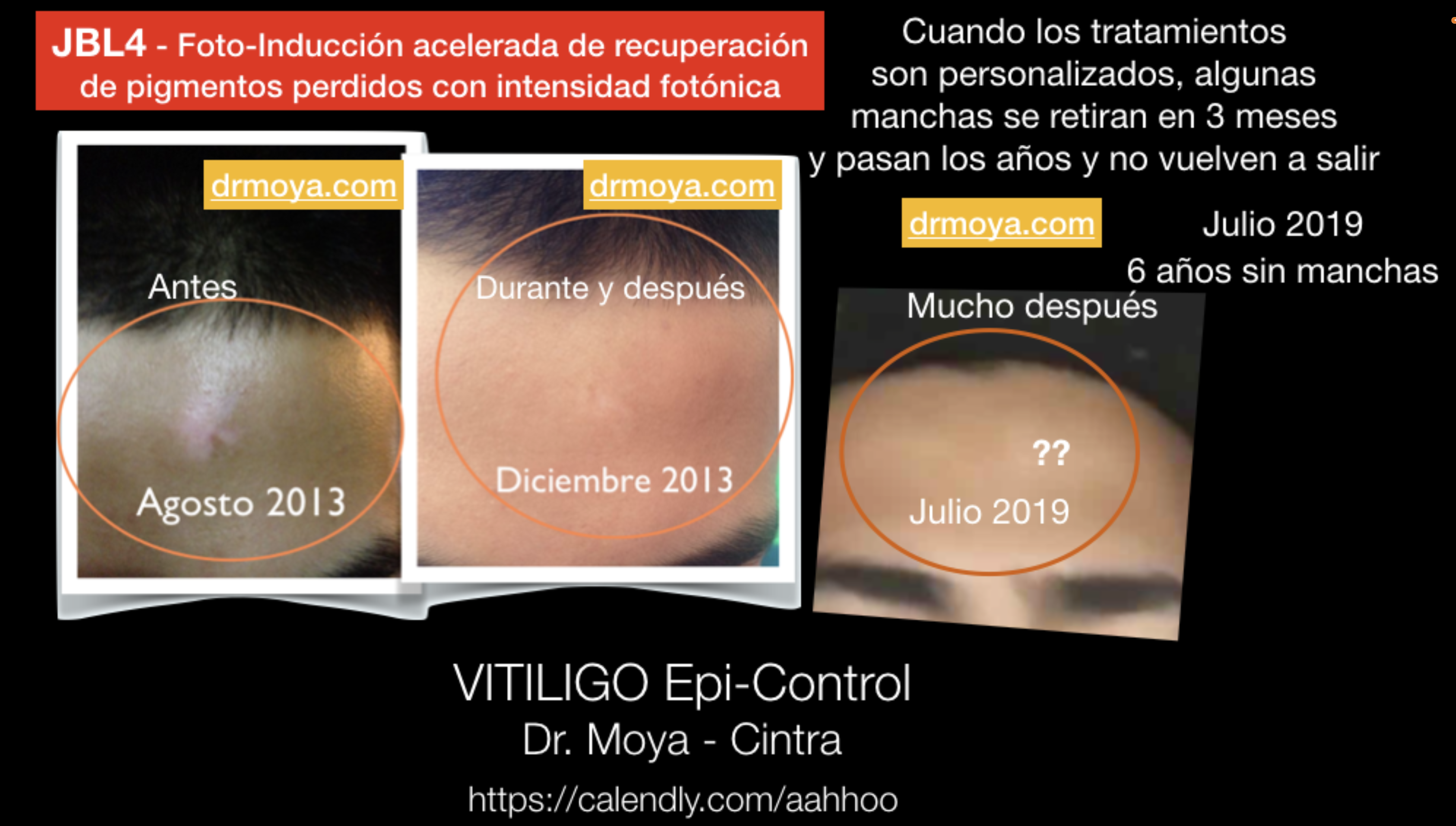 testimonios_libro_evitando_y_controlando_vitiligo_4.png