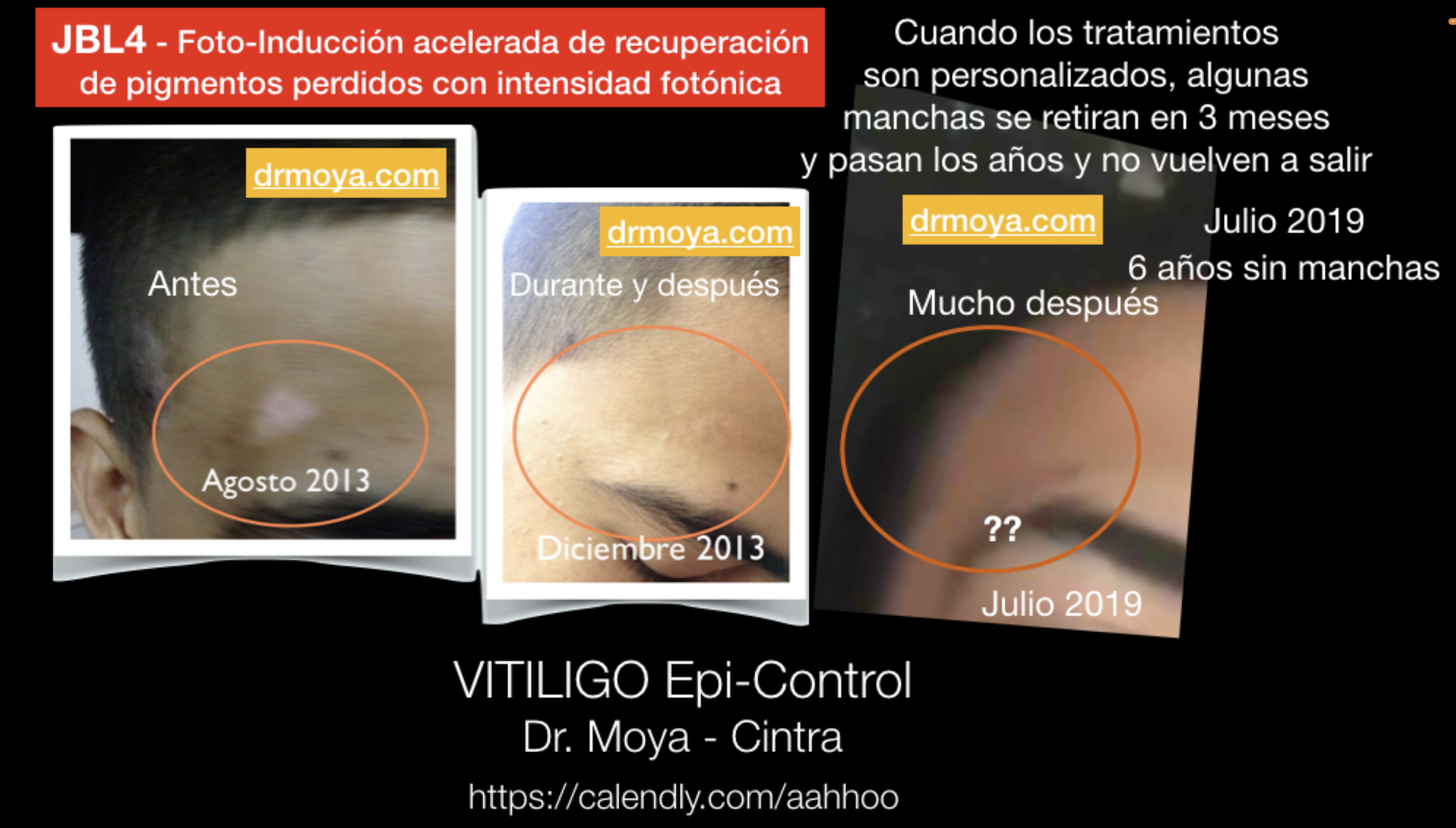 testimonios_libro_evitando_y_controlando_vitiligo_5.png