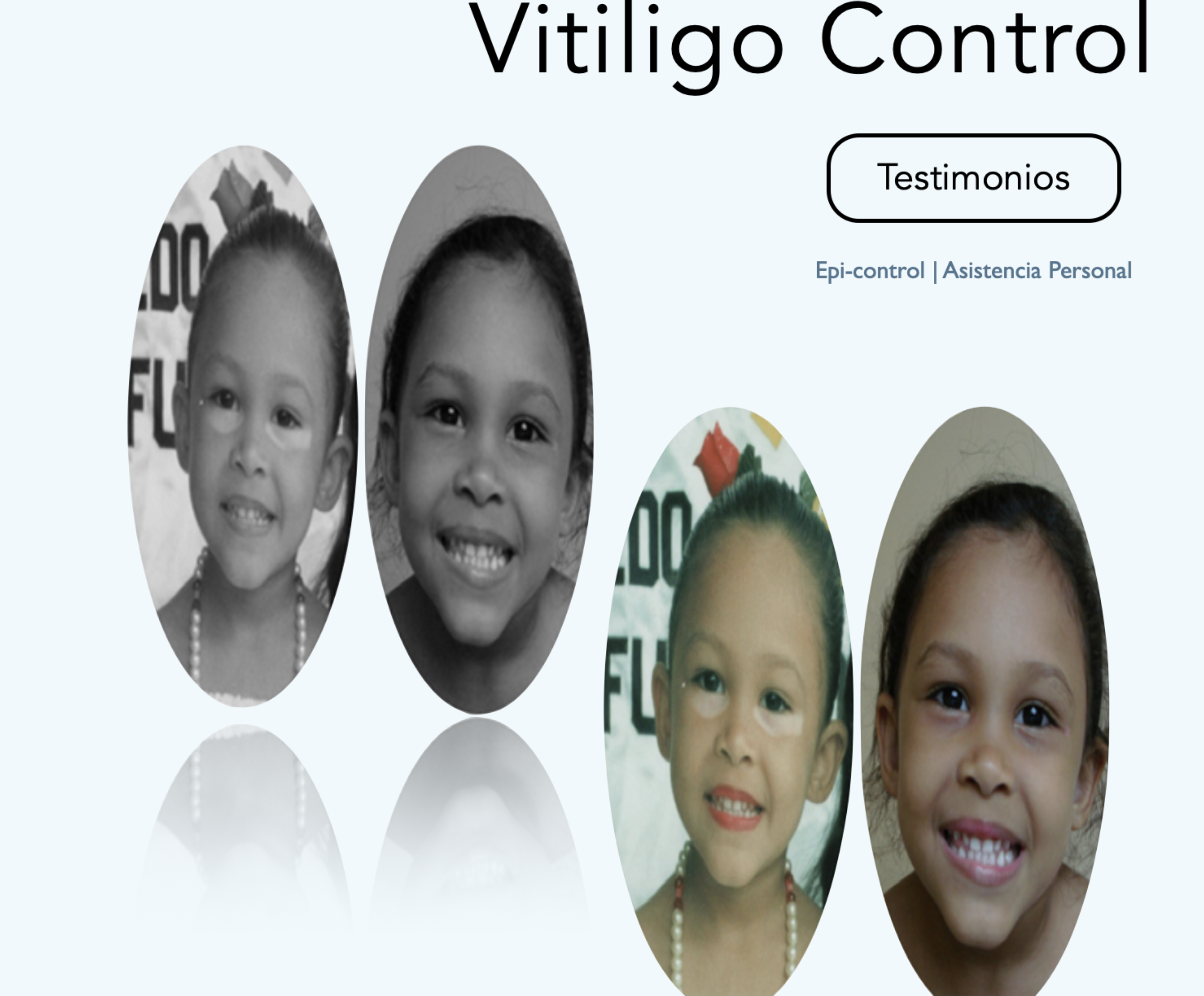 testimonios_libro_evitando_y_controlando_vitiligo_10.png