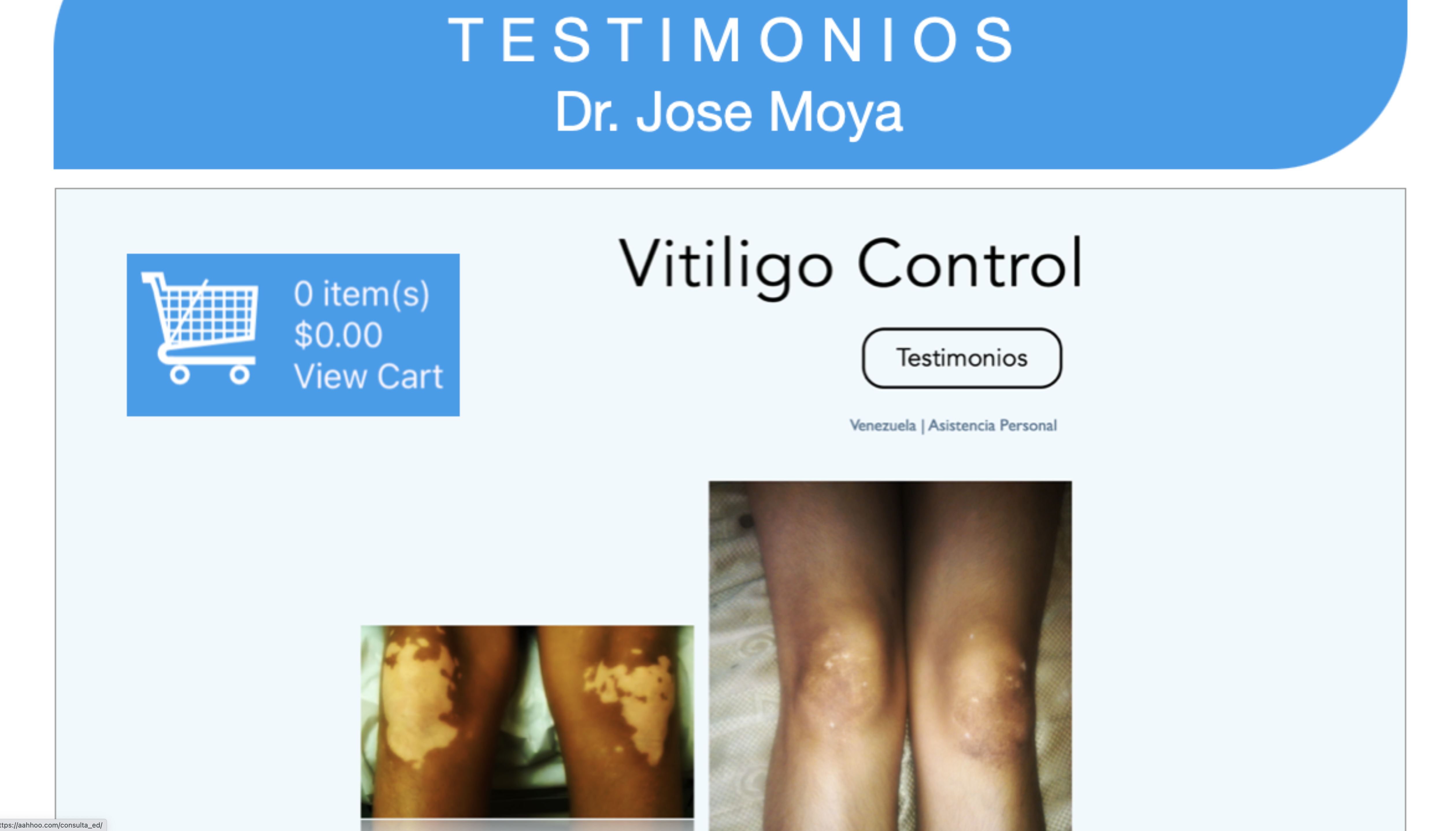 testimonios_libro_evitando_y_controlando_vitiligo_6.png