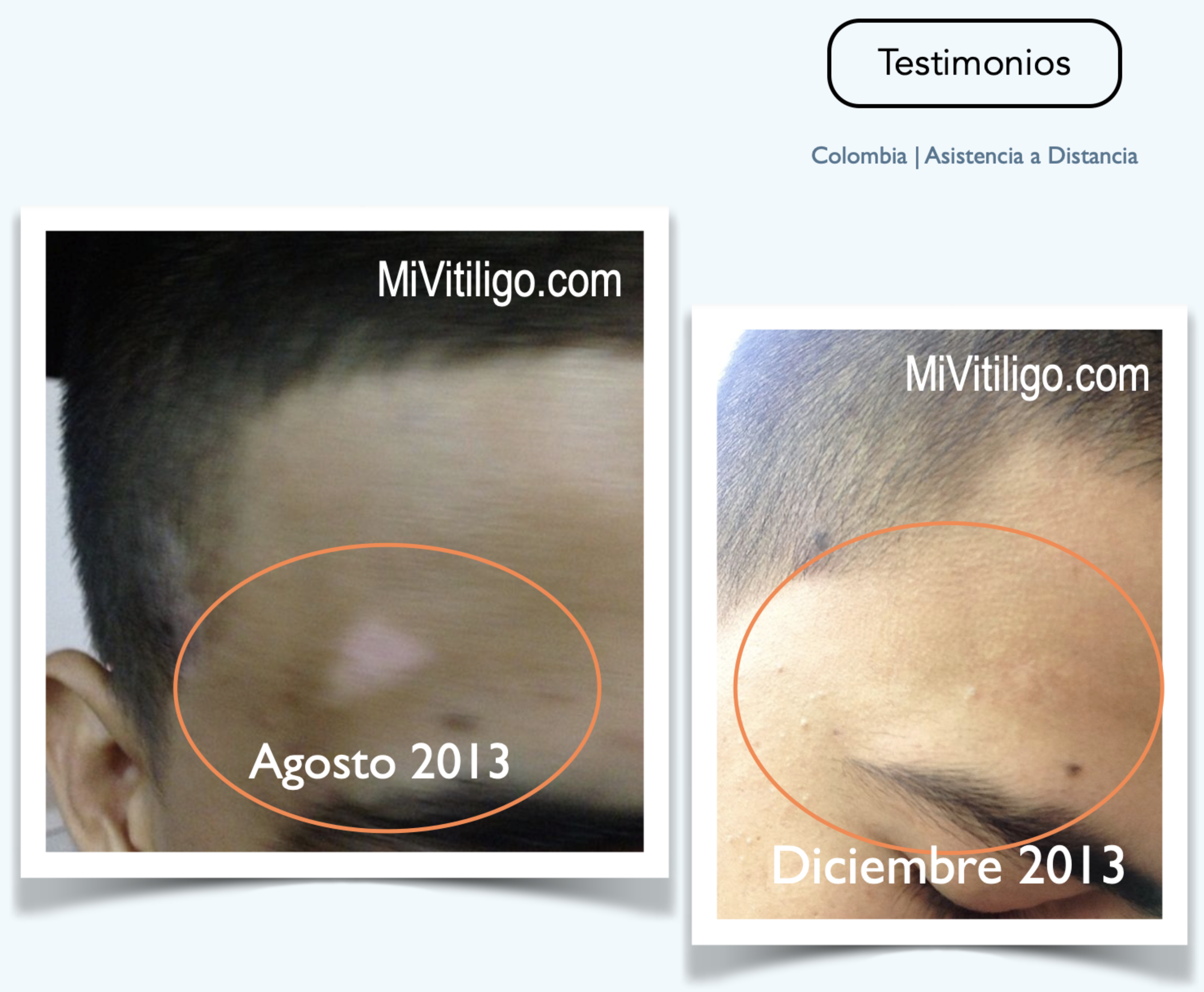 testimonios_libro_evitando_y_controlando_vitiligo_12.png